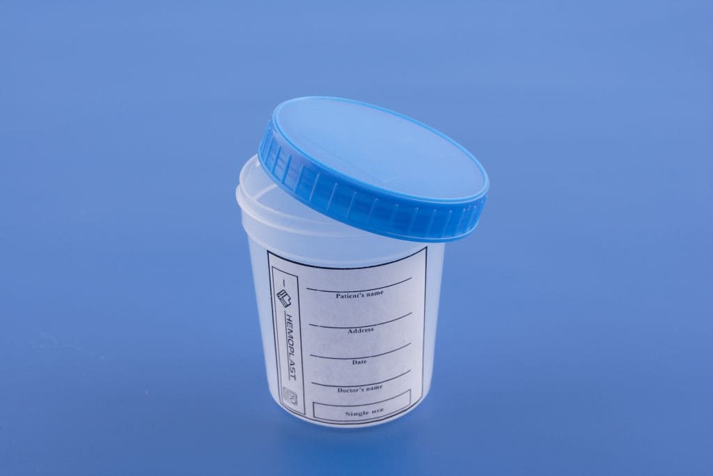 Ємкість для забору сечі 200 мл